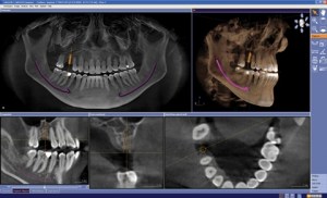 3D CBCT Technology display