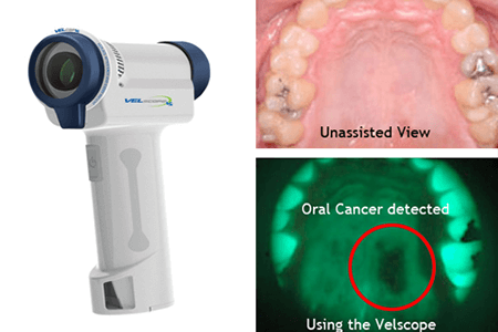 VELscope® Vx handheld device