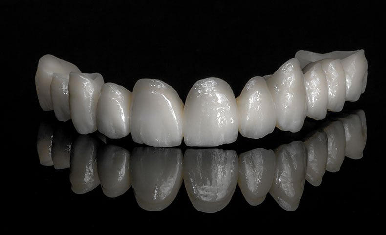 porcelain crowns