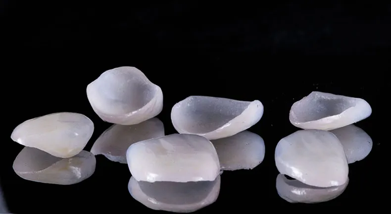 porcelain veneers