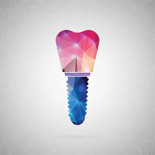 colorful rendering of a crown and implant